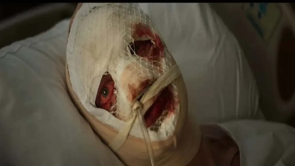 Clayface teaser showing bandaged face with exposed wounds symbolizing transformation and identity loss